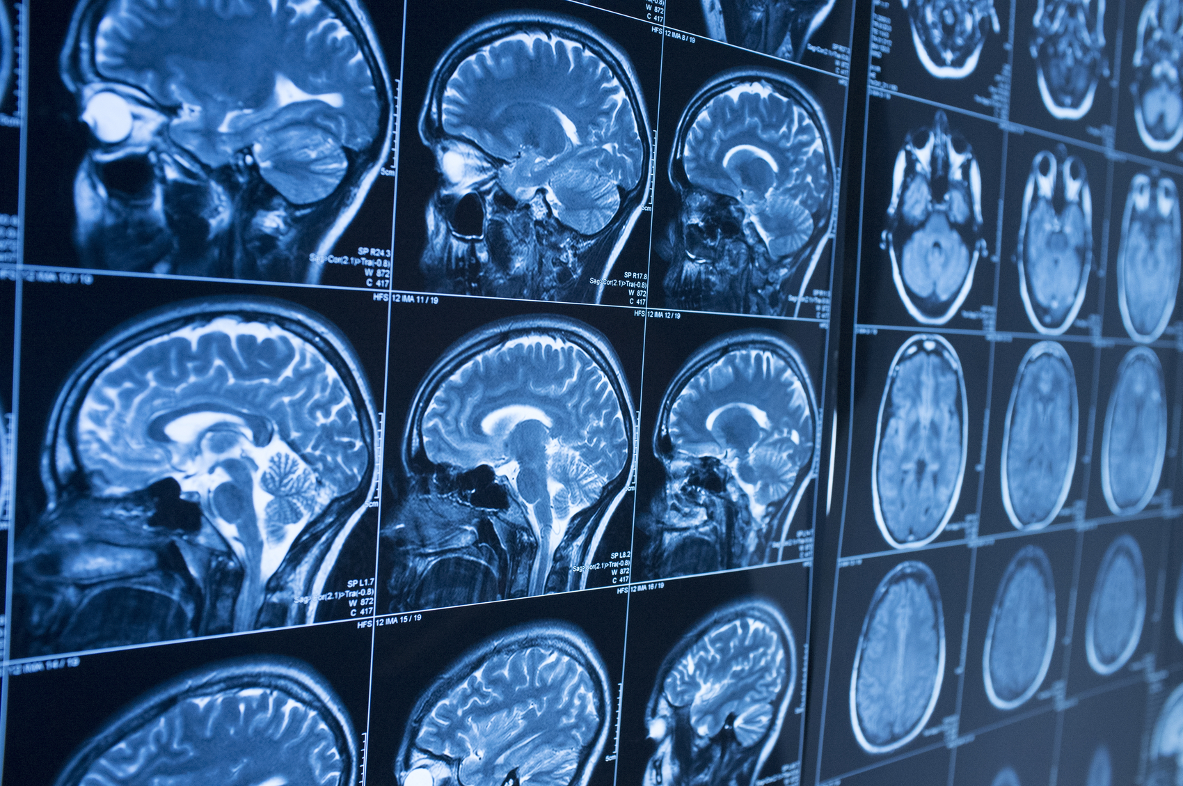 March Is Brain Injury Awareness Month 2021
