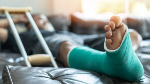 The High Cost of Broken Bones