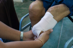 What Complications Come With Amputations?