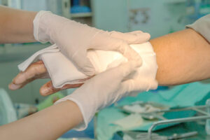 How Alpert Schreyer Personal Injury Lawyers Can Help After A Burn Accident In Waldorf, MD