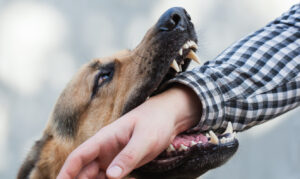 How Alpert Schreyer Personal Injury Lawyers Can Help After a Dog Bite in Maryland