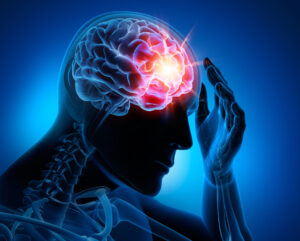 Why Choose Alpert Schreyer Personal Injury Lawyers for Help After a Brain Injury in Charles County, MD?
